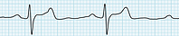 The Latest Evidence in Hypertension & Stroke