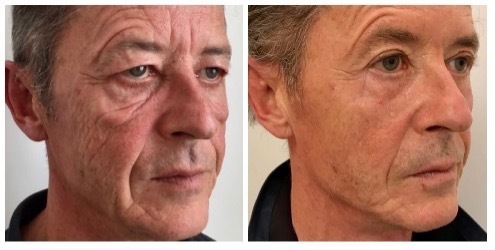 2021 – The Aesthetics Award for Best Surgical Result