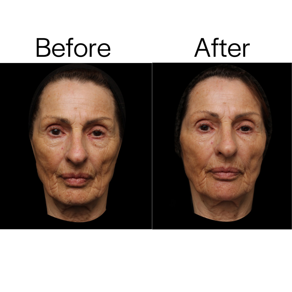 2023 - The Healthxchange Award for Best Non-Surgical Result